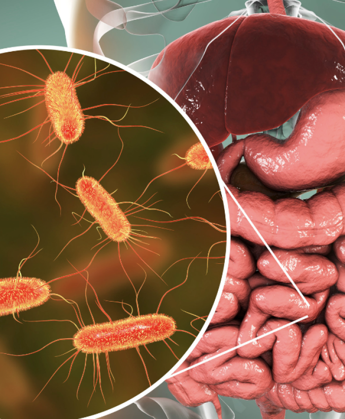 Técnica dos 6R’s: abordagem para tratar Disbiose e Permeabilidade Intestinal